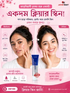 Lion Pair Acne Care Cream 14g