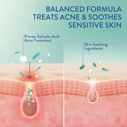 Acne/Pimple, Face Care, Serums, Oil, Skin, Skin Treatment, Treatment, Japan Mart