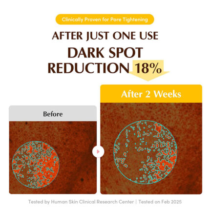 Face, Care, Face Care, K-Beauty, Sheet, Mask, Sheet Mask, Skin, Japan Mart